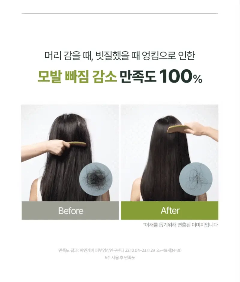 [소용량한정] 려 루트젠 여성맞춤볼륨 탈모증상전문케어 샴푸 242ML 상세페이지 15
